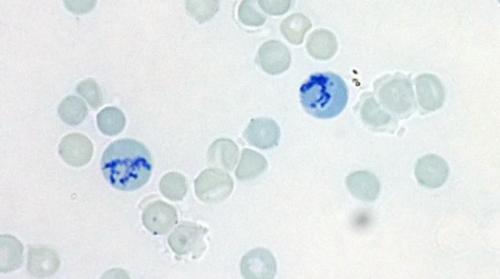 Ретикулоциты